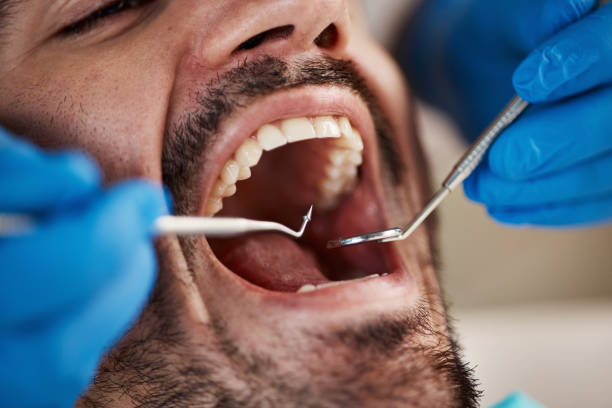 Best Emergency Dental Surgery in St Peter, WI